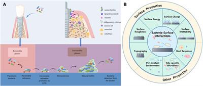 Overview of strategies to improve the antibacterial property of dental implants